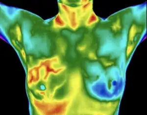 Advanced Thermography