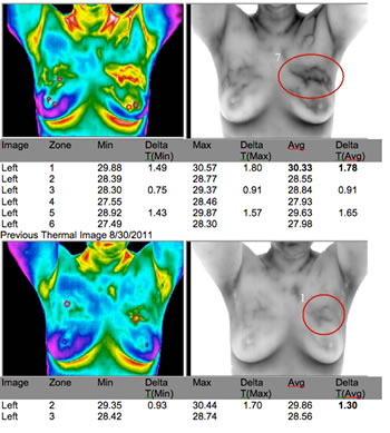 Nutraceuticals Nutrition 6mo changes