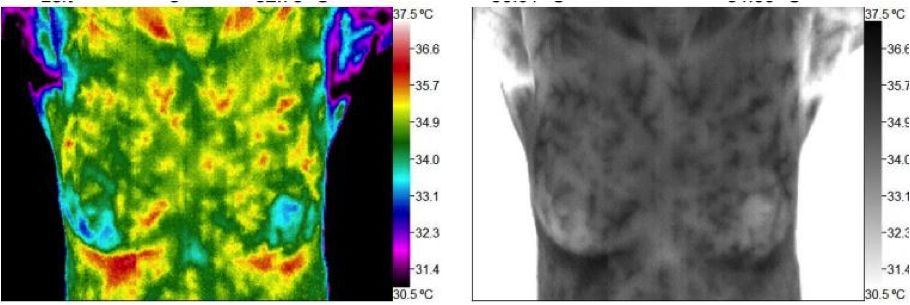 thermography prior exam