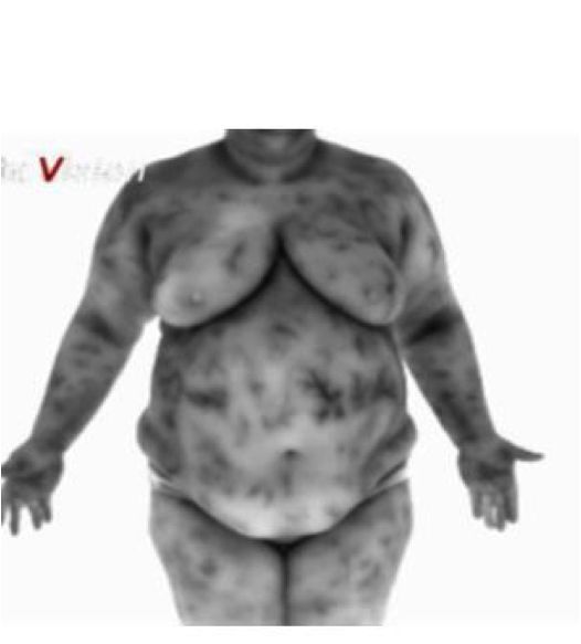 thermography for metabolic detox
