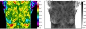 thermography prior exam