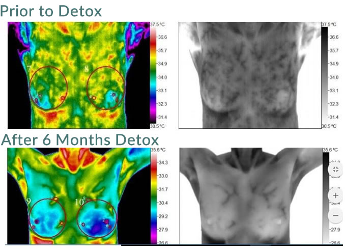 before and after 6 months detox